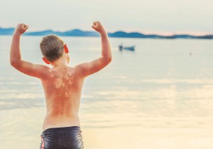 Reisekrankheiten bei Kindern, Sonnenbrand / Magazin SCHULE